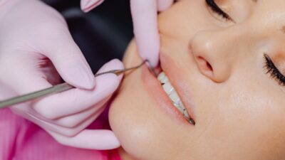 how-long-do-crowns-last-on-front-teeth
