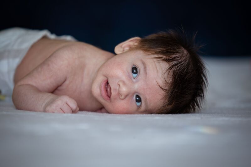 how-to-get-rid-of-baby-acne