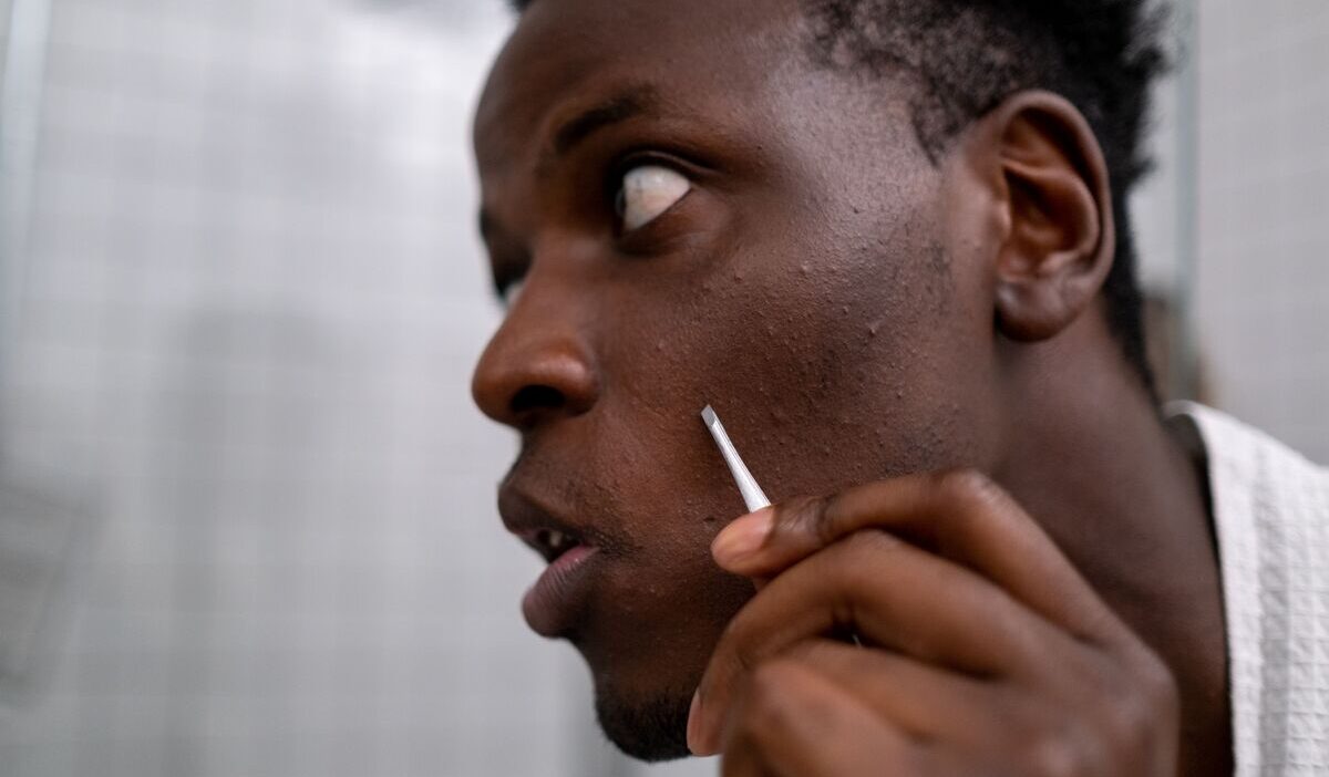 how-to-get-rid-of-razor-bumps-overnight