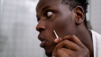 how-to-get-rid-of-razor-bumps-overnight